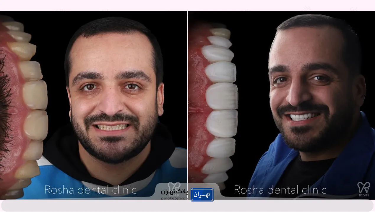 مرکز دندانپزشکی و ایمپلنت در سعادت آباد روشا