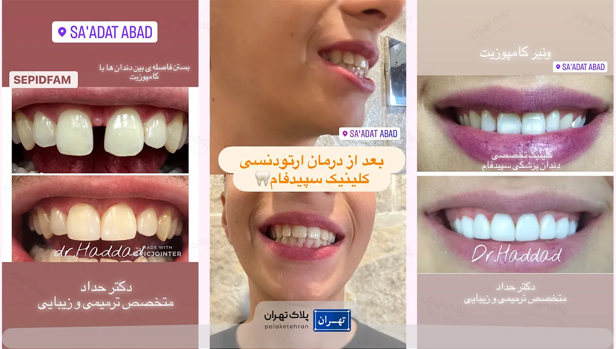 کلینیک دندانپزشکی در سعادت آباد تهران سپیدفام
