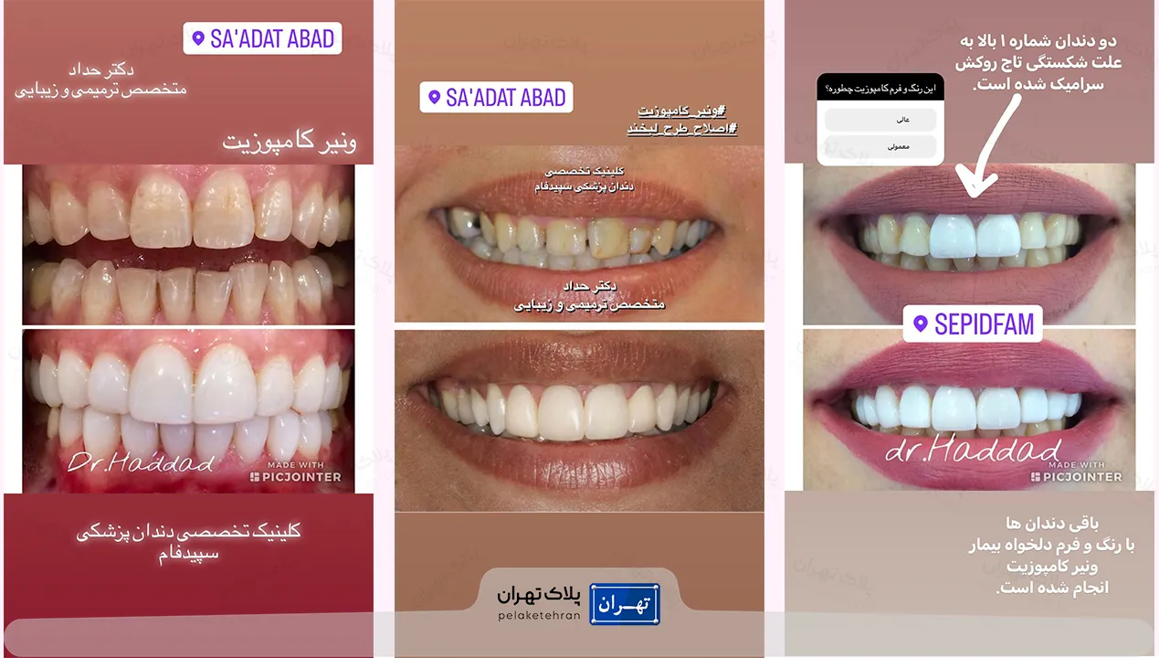 کلینیک دندانپزشکی در سعادت آباد تهران سپیدفام