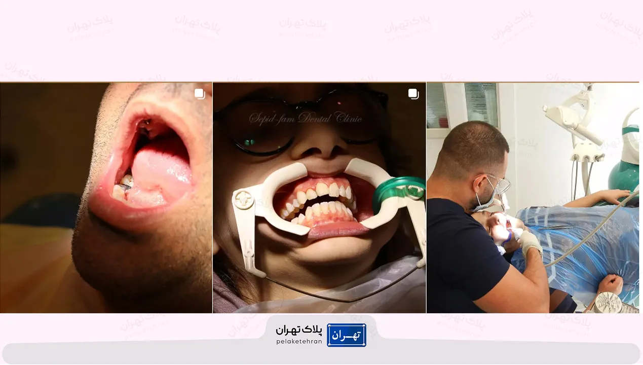 کلینیک دندانپزشکی در سعادت آباد تهران سپیدفام