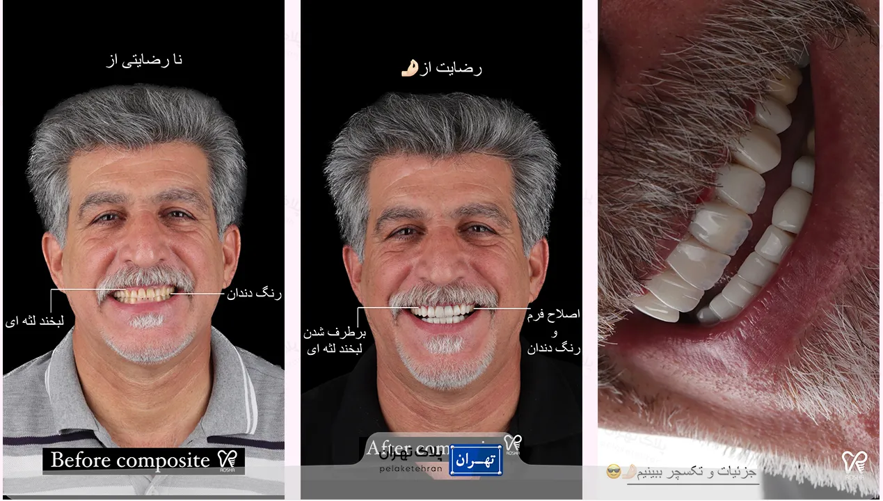 مرکز دندانپزشکی و ایمپلنت در سعادت آباد روشا