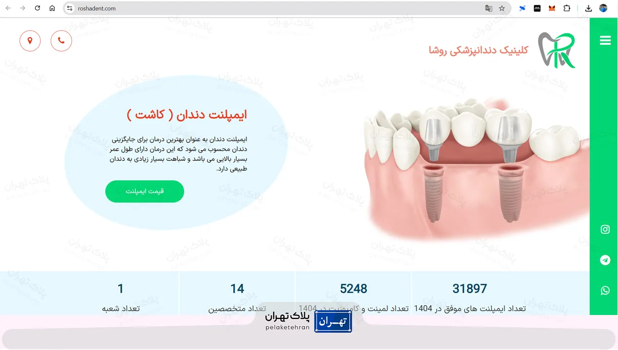 سایت مرکز دندانپزشکی و ایمپلنت در سعادت آباد روشا