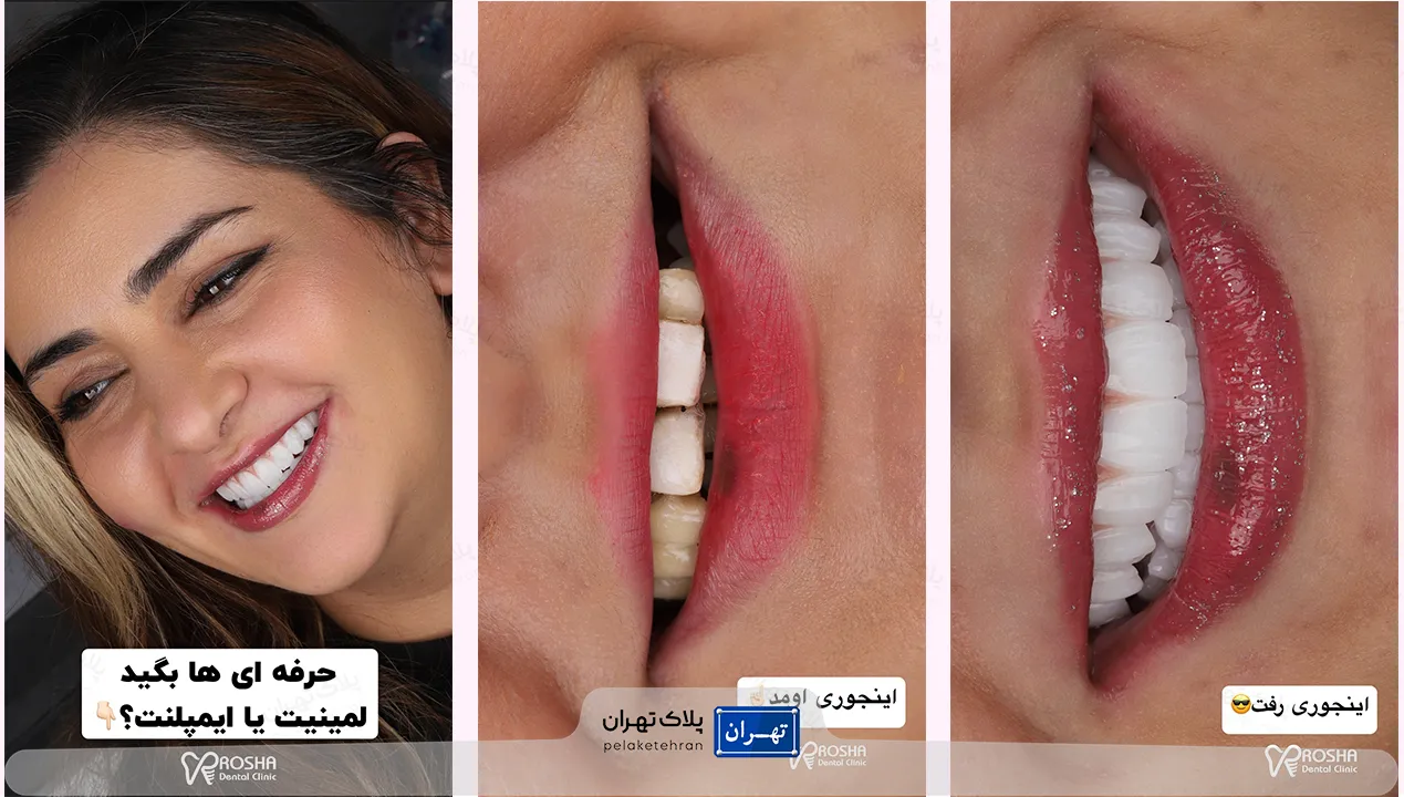 مرکز دندانپزشکی و ایمپلنت در سعادت آباد روشا