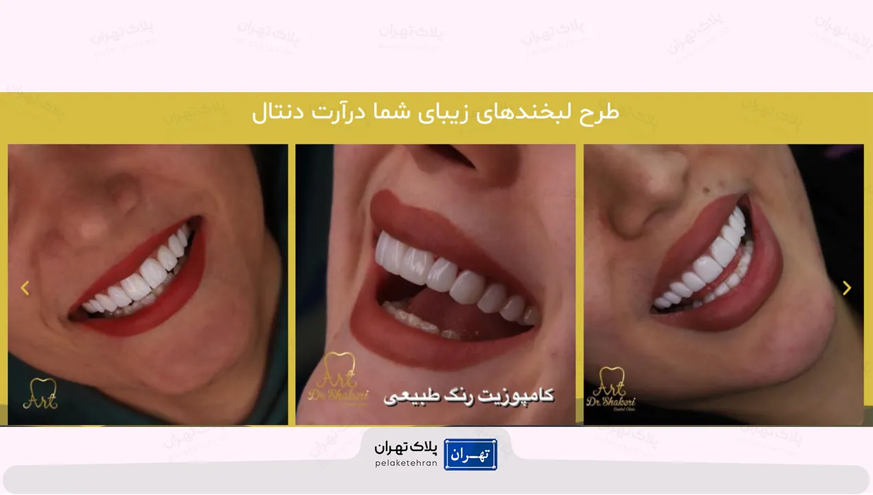 مرکز دندانپزشکی غرب تهران آرت (دکتر طاهره شاکری اصیل)