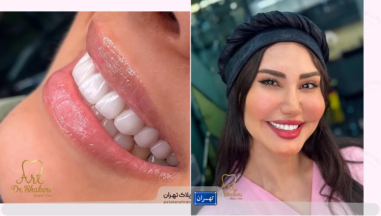 مرکز دندانپزشکی غرب تهران آرت (دکتر طاهره شاکری اصیل)