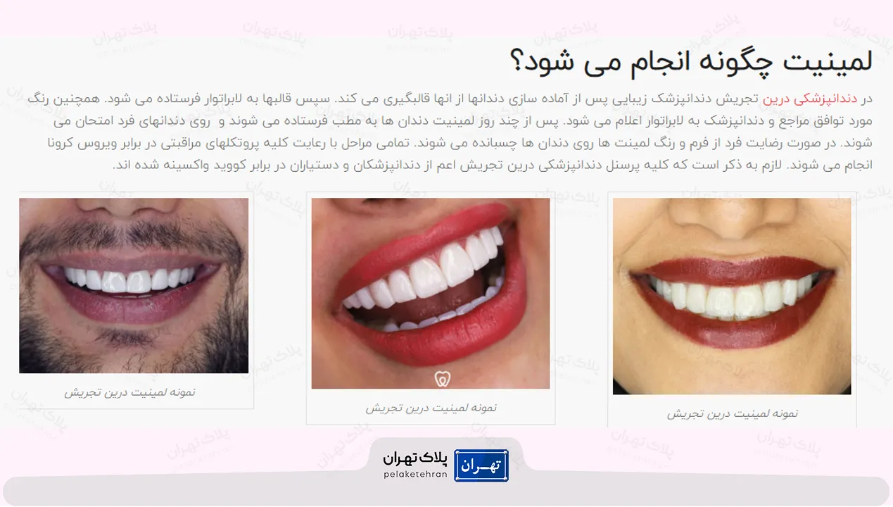 لمینت در کلینیک دندانپزشکی درین تجریش