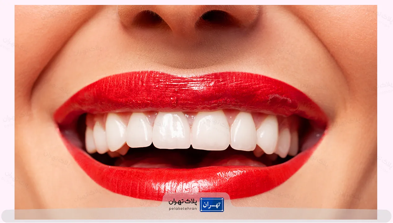 کلینیک دندانپزشکی درین تجریش
