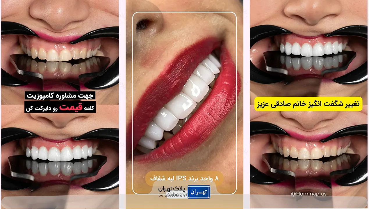 کلینیک دندانپزشکی غرب تهران هومینا