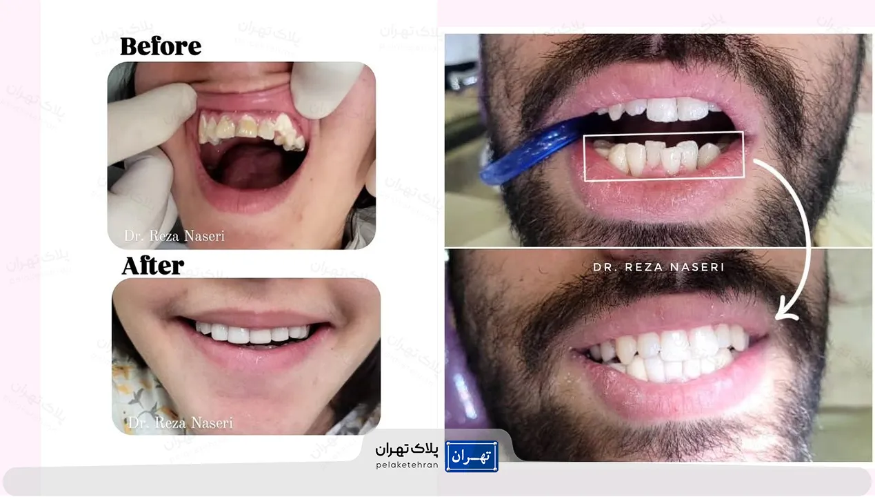 کلینیک شبانه روزی دندانپزشکی سعادت آباد دکتر ناصری