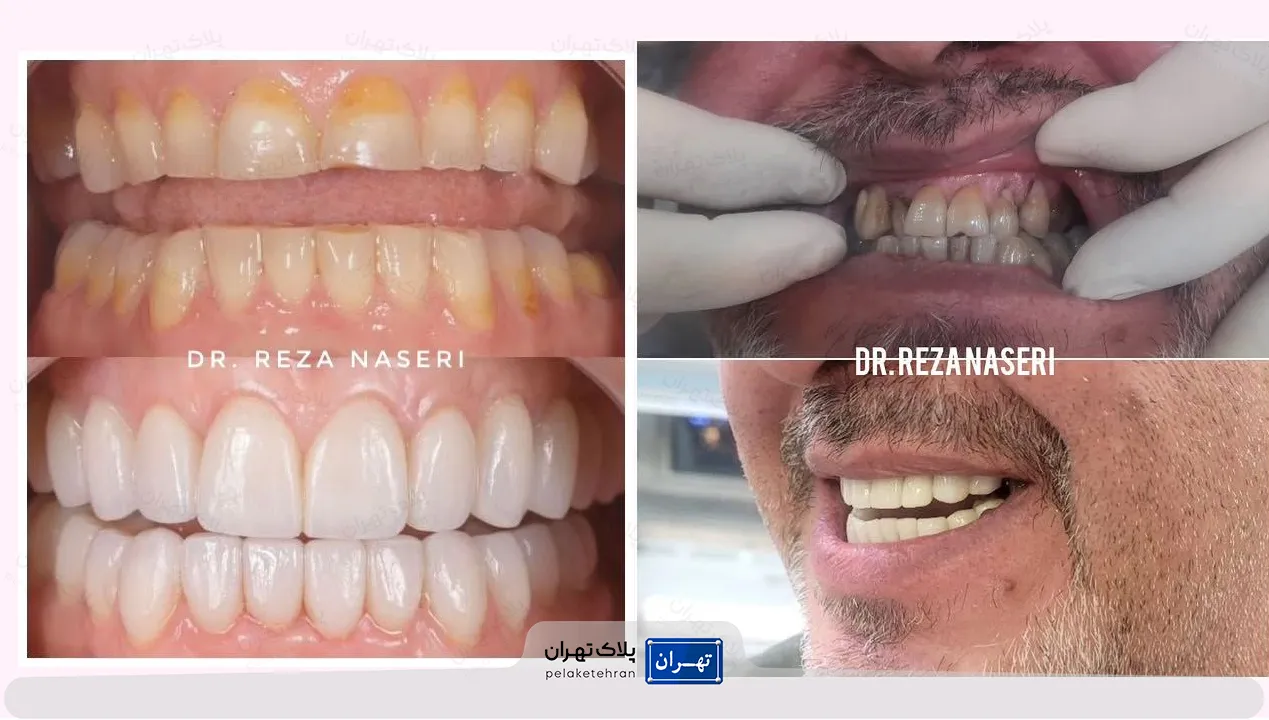 کلینیک شبانه روزی دندانپزشکی سعادت آباد دکتر ناصری