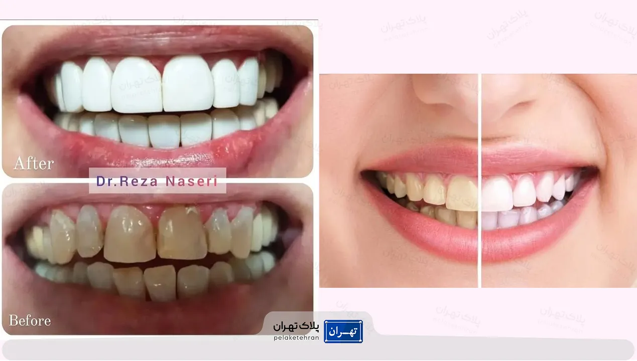 کلینیک شبانه روزی دندانپزشکی سعادت آباد دکتر ناصری